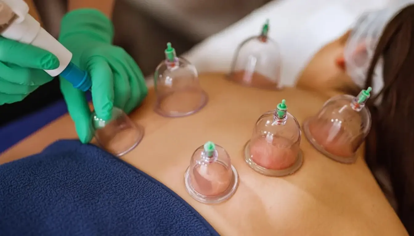 Certified female Hijama practitioner applying cupping therapy to a female patient's back in a private, sterile treatment room
